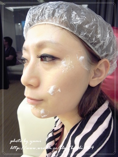 星和台北_雷射除痣_娃娃04 星和台北_雷射除痣_娃娃04