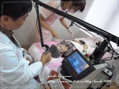 星和台北_雷射除痣_娃娃07 星和台北_雷射除痣_娃娃07