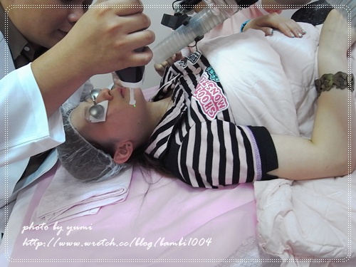 星和台北_雷射除痣_娃娃08 星和台北_雷射除痣_娃娃08