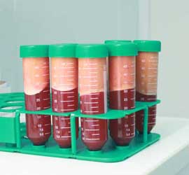 星采整形外科診所_自體脂肪豐胸_邱大睿醫師13 星采整形外科診所_自體脂肪豐胸_邱大睿醫師13