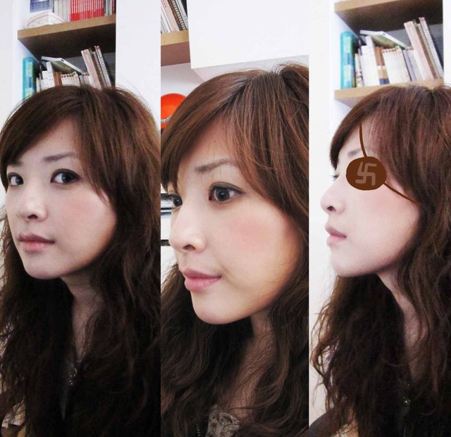 星和台北_整形外科墊下巴_ 邱大睿醫師13 星和台北_整形外科墊下巴_ 邱大睿醫師13