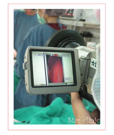 星采星和_果凍隆乳12 星采星和_果凍隆乳12