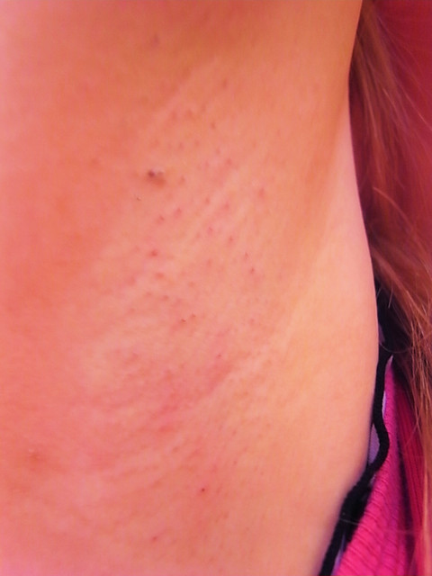 星采星和_除毛雷射21 星采星和_除毛雷射21