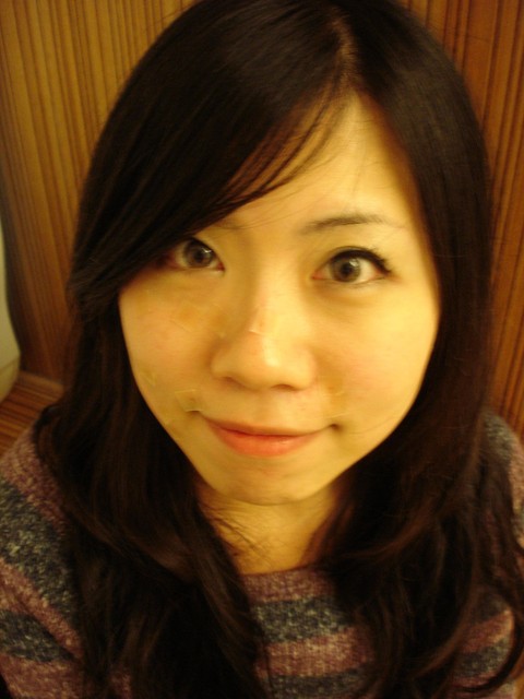 星采古亭_雷射除痣_哈哈04 星采古亭_雷射除痣_哈哈04