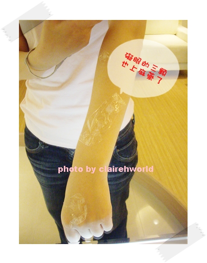 星采古亭_雷射除痣_Claireh01 星采古亭_雷射除痣_Claireh01