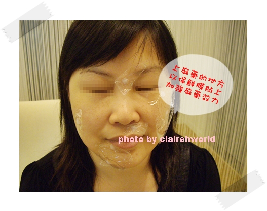 星采古亭_雷射除痣_Claireh11 星采古亭_雷射除痣_Claireh11