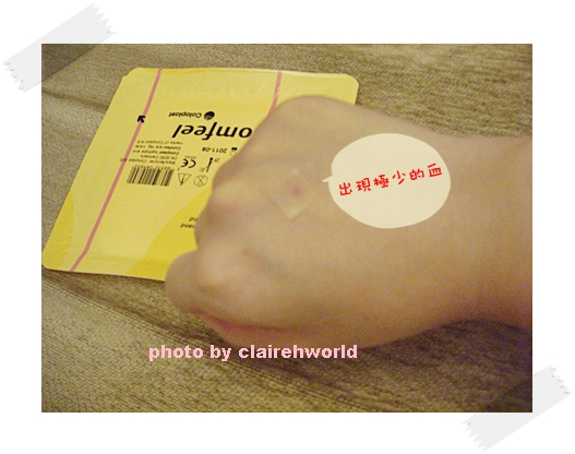 星采古亭_雷射除痣_Claireh22 星采古亭_雷射除痣_Claireh22