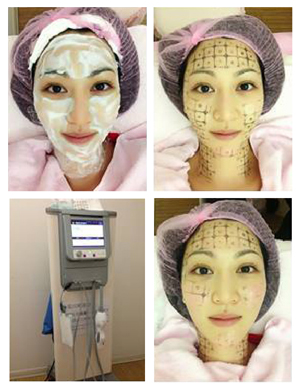 星和台北_電波拉皮_曾莞婷01 星和台北_電波拉皮_曾莞婷01