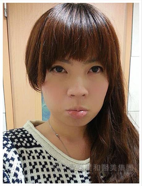 星采大安_櫻花染料雷射_淑鈴09 星采大安_櫻花染料雷射_淑鈴09