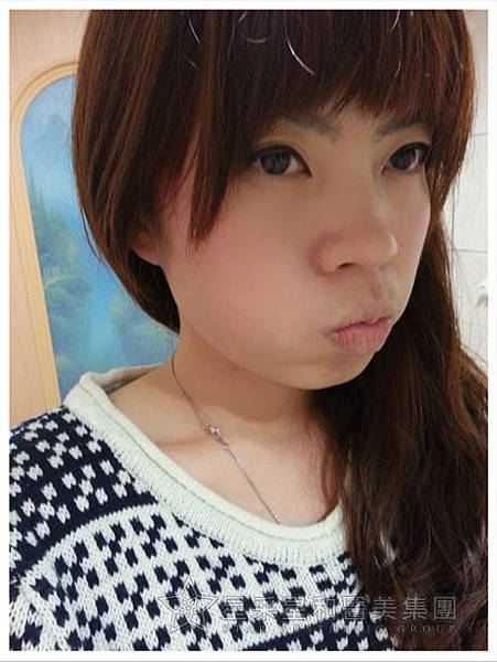 星采大安_櫻花染料雷射_淑鈴10 星采大安_櫻花染料雷射_淑鈴10