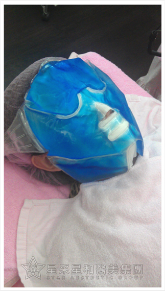 星采大安_櫻花染料雷射_淑鈴05 星采大安_櫻花染料雷射_淑鈴05