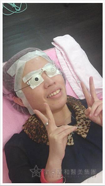 星采大安_櫻花染料雷射_淑鈴04 星采大安_櫻花染料雷射_淑鈴04