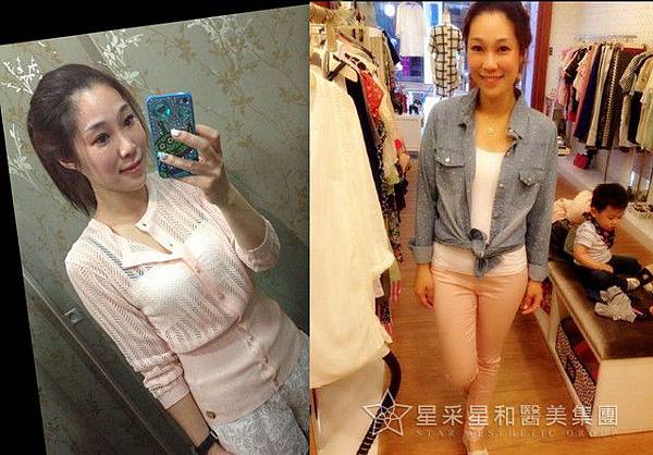 星采古亭_電波拉皮_黑松露17 星采古亭_電波拉皮_黑松露17