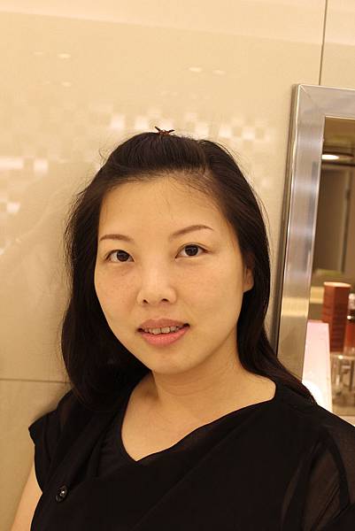 星采大安_眼袋淚溝填平_邱大睿院長12 星采大安_眼袋淚溝填平_邱大睿院長12