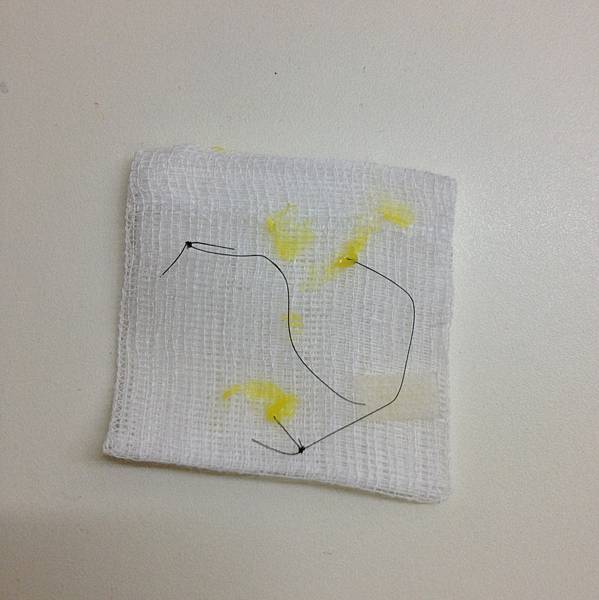 星采大安_眼袋淚溝填平_邱大睿院長11 星采大安_眼袋淚溝填平_邱大睿院長11