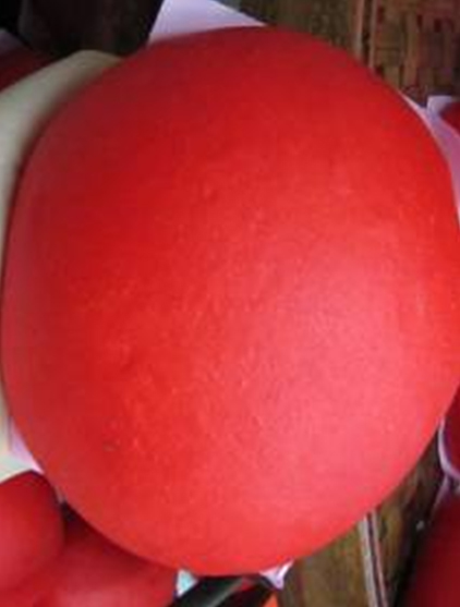 星采大安_眼袋淚溝填平_邱大睿院長09 星采大安_眼袋淚溝填平_邱大睿院長09