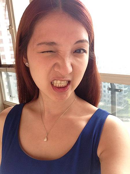 星采大安醫美_韓式隆鼻/三段式隆鼻_邱大睿院長19 星采大安醫美_韓式隆鼻/三段式隆鼻_邱大睿院長19