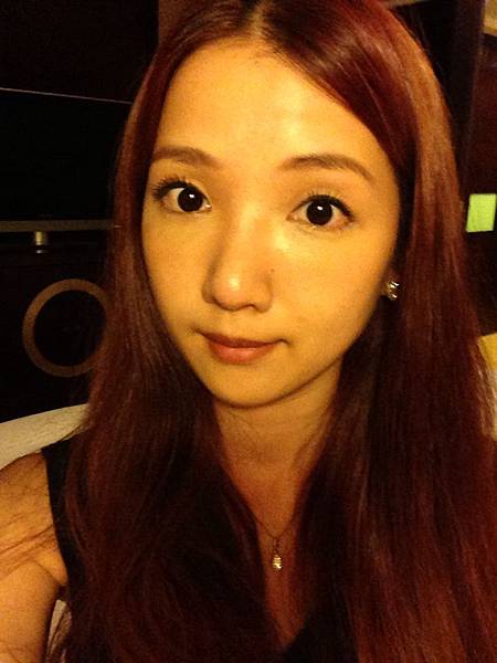 星采大安醫美_韓式隆鼻/三段式隆鼻_邱大睿院長17 星采大安醫美_韓式隆鼻/三段式隆鼻_邱大睿院長17