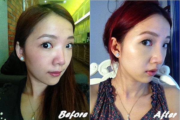 星采大安醫美_韓式隆鼻/三段式隆鼻_邱大睿院長15 星采大安醫美_韓式隆鼻/三段式隆鼻_邱大睿院長15