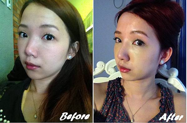 星采大安醫美_韓式隆鼻/三段式隆鼻_邱大睿院長14 星采大安醫美_韓式隆鼻/三段式隆鼻_邱大睿院長14