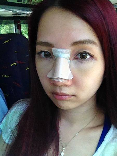 星采大安醫美_韓式隆鼻/三段式隆鼻_邱大睿院長11 星采大安醫美_韓式隆鼻/三段式隆鼻_邱大睿院長11