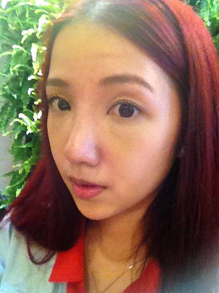 星采大安醫美_韓式隆鼻/三段式隆鼻_邱大睿院長12 星采大安醫美_韓式隆鼻/三段式隆鼻_邱大睿院長12