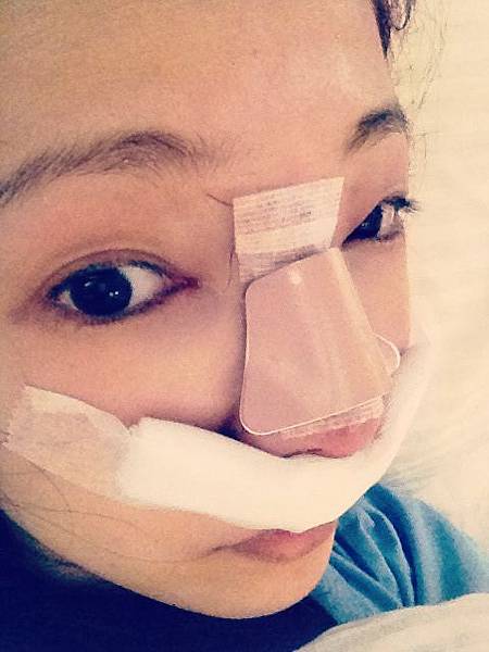 星采大安醫美_韓式隆鼻/三段式隆鼻_邱大睿院長09 星采大安醫美_韓式隆鼻/三段式隆鼻_邱大睿院長09