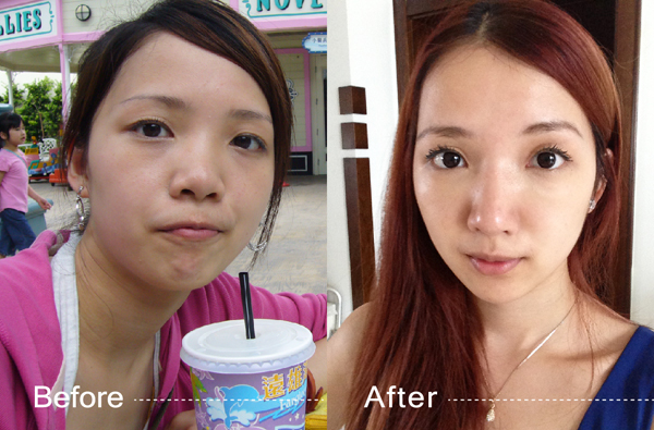 星采大安醫美_韓式隆鼻/三段式隆鼻_邱大睿院長02 星采大安醫美_韓式隆鼻/三段式隆鼻_邱大睿院長02