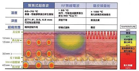 星和台中_極線音波拉提_小米05