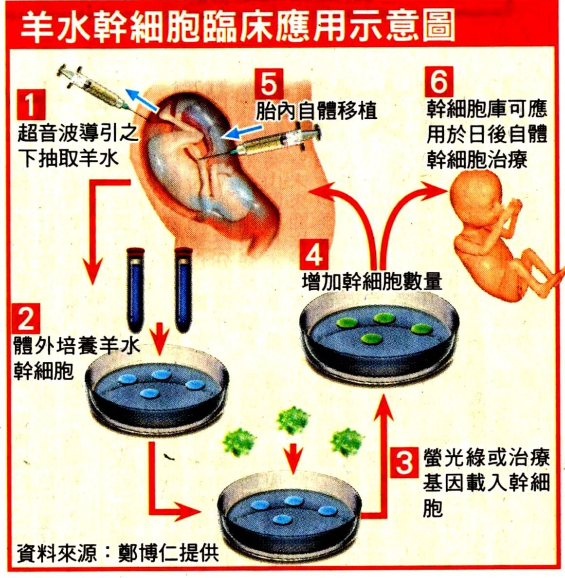 1001212蘋果日報羊水幹細胞能用作治療(圖).jpg