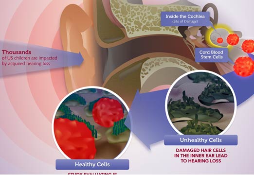 hearing_loss_infographic