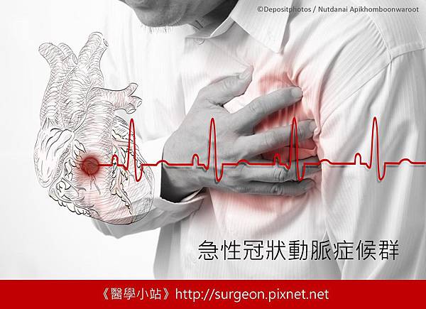 急性冠狀動脈症候群