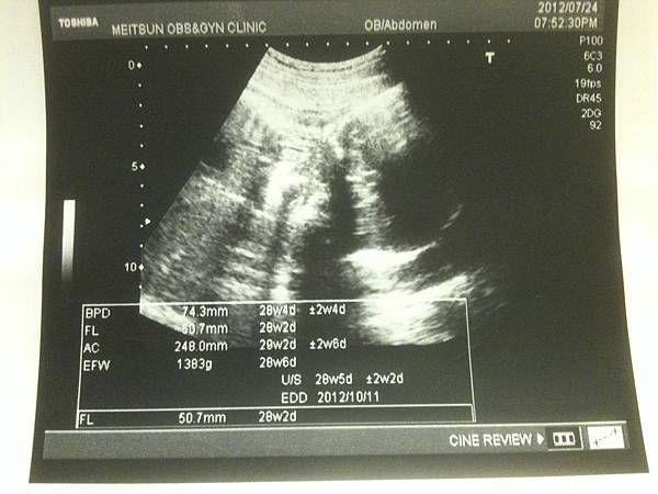 28w2d 28w2d