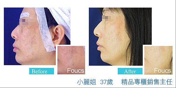 000004.jpg 000004.jpg