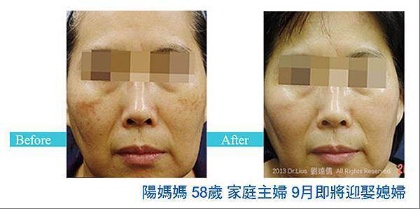 000003.jpg 000003.jpg