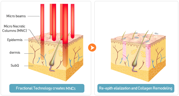 1183093198 1183093198