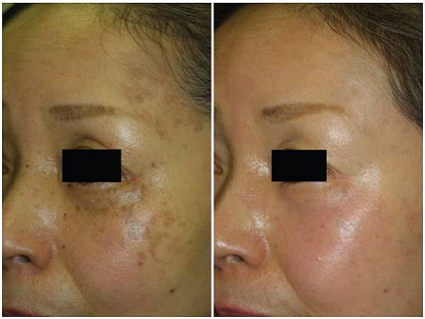 1183103258 1183103258