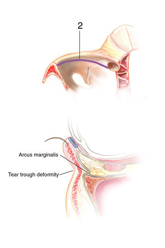 1183103203 1183103203