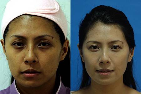 不要再冤枉眼袋了~~