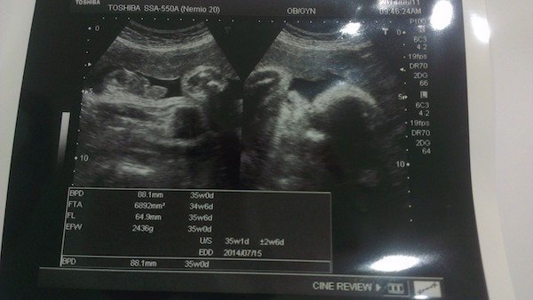 IMAG5317.jpg IMAG5317.jpg