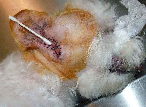 部份垂直耳道摘除