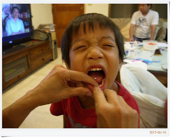 初次換牙_20120610-006