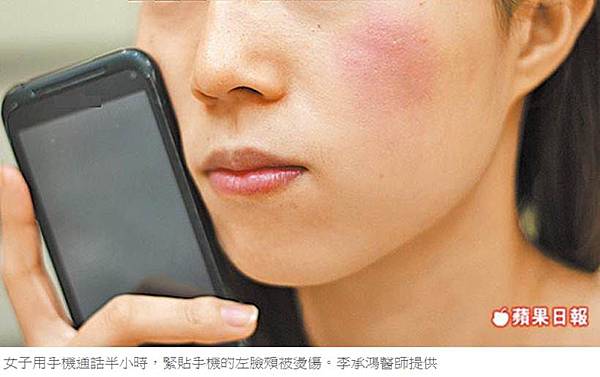 充太久? iPhone 充電中會自燃? - 電腦王阿達 手機燙傷