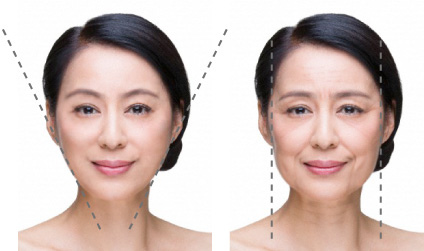 熟齡女性的臉部變化圖2