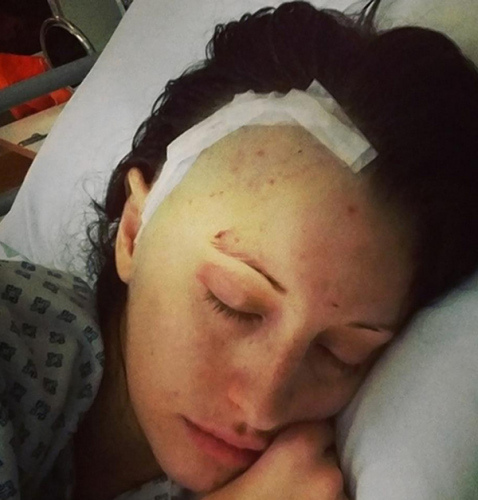 黃驛娛樂城//花花公子女郎腦部手術後性格大變　成害羞女