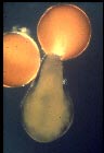 outcyst.jpg