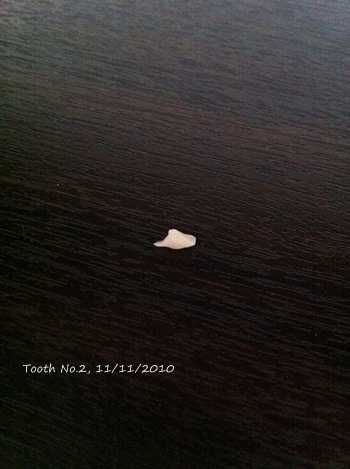 IP_20101111_IMG_0411.JPG IP_20101111_IMG_0411.JPG