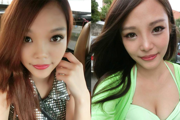 B&A-1