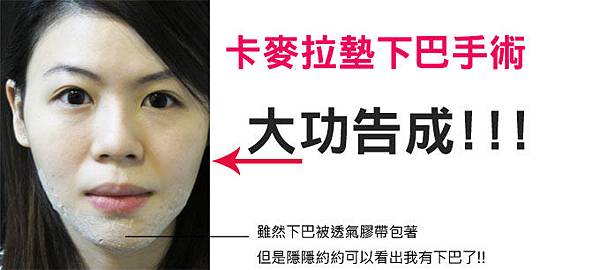 手術結術