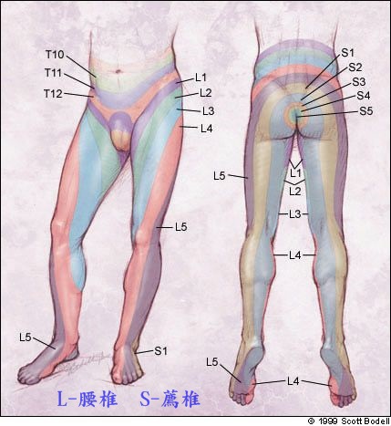 坐骨神經痛